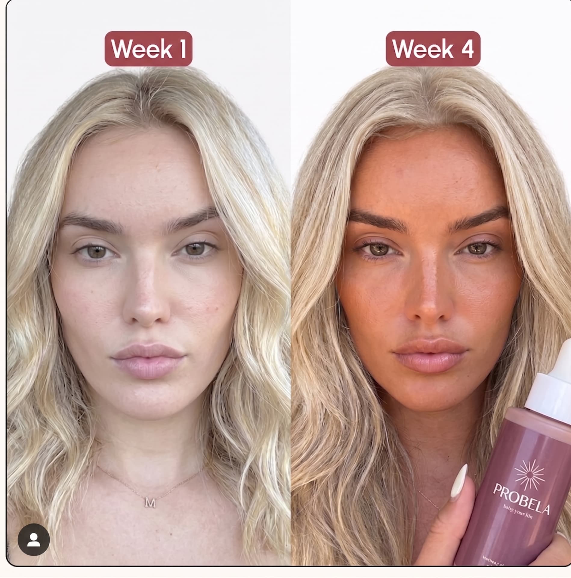 Semana 1 vs Semana 4 — Beatriz T. com PROBELA Glow Drops