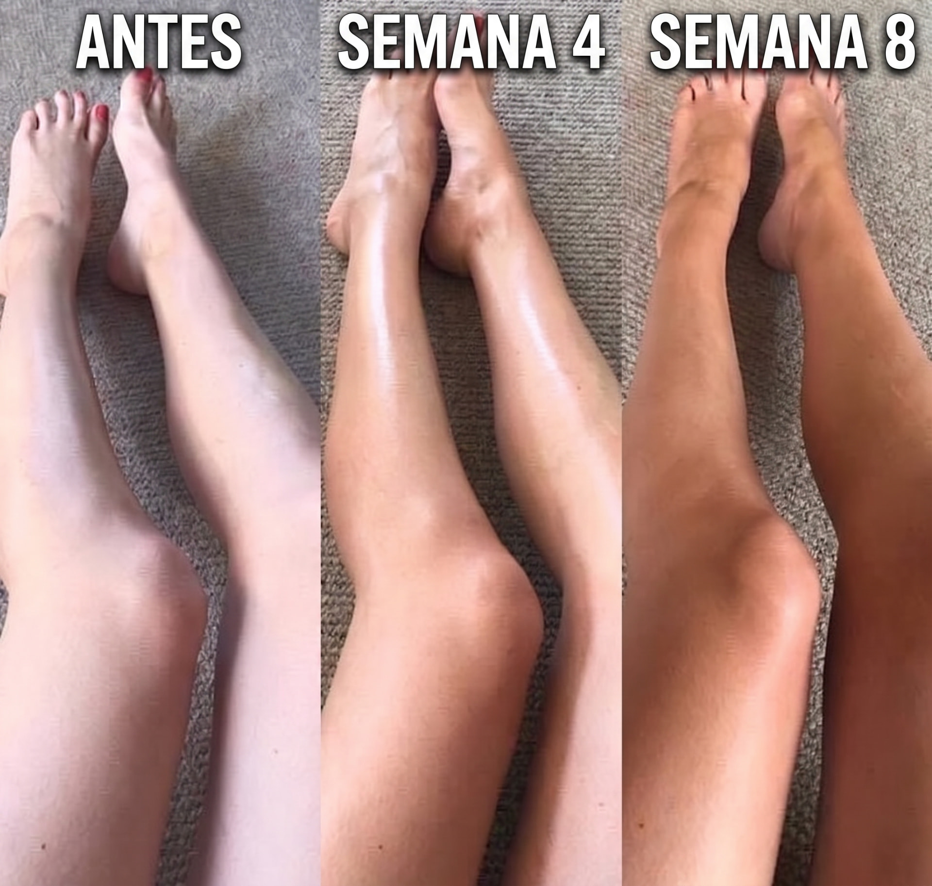 Semana 1 vs semana 4 de Sofia M. com PROBELA Glow Drops