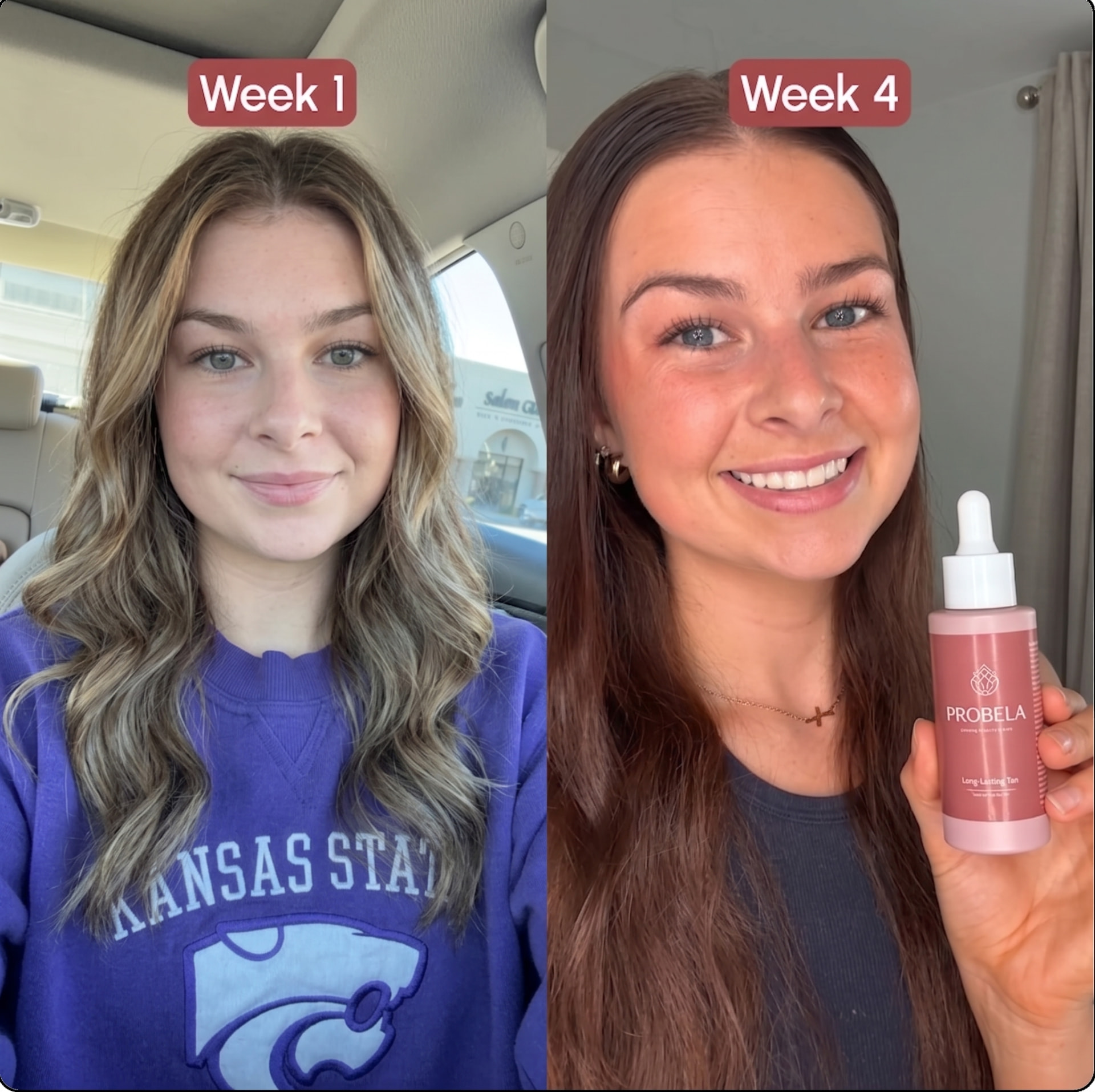 Semana 1 vs semana 4 de Arielle H. com PROBELA Glow Drops