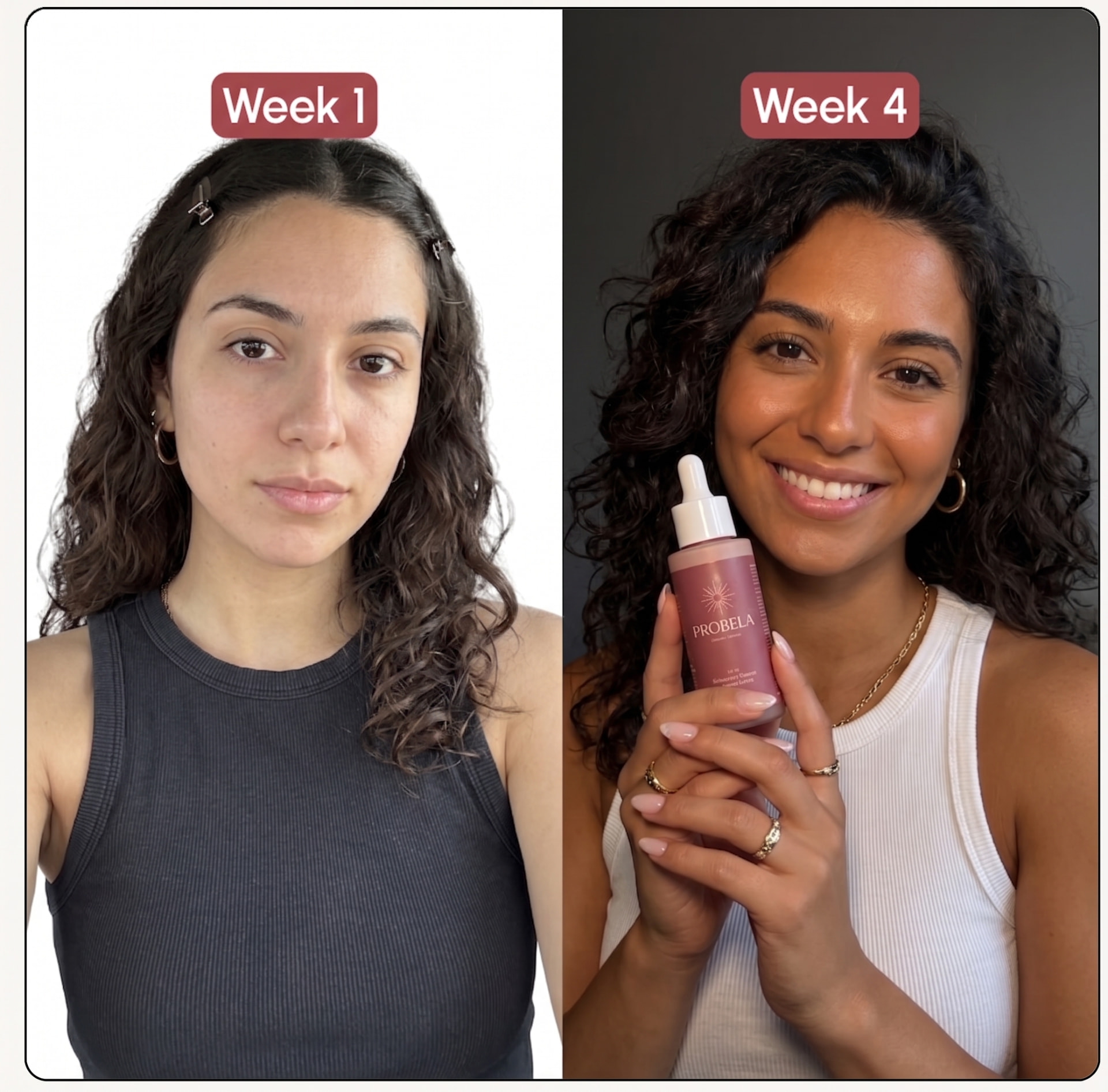 Semana 1 vs Semana 4 — Madelyn I. com PROBELA Glow Drops