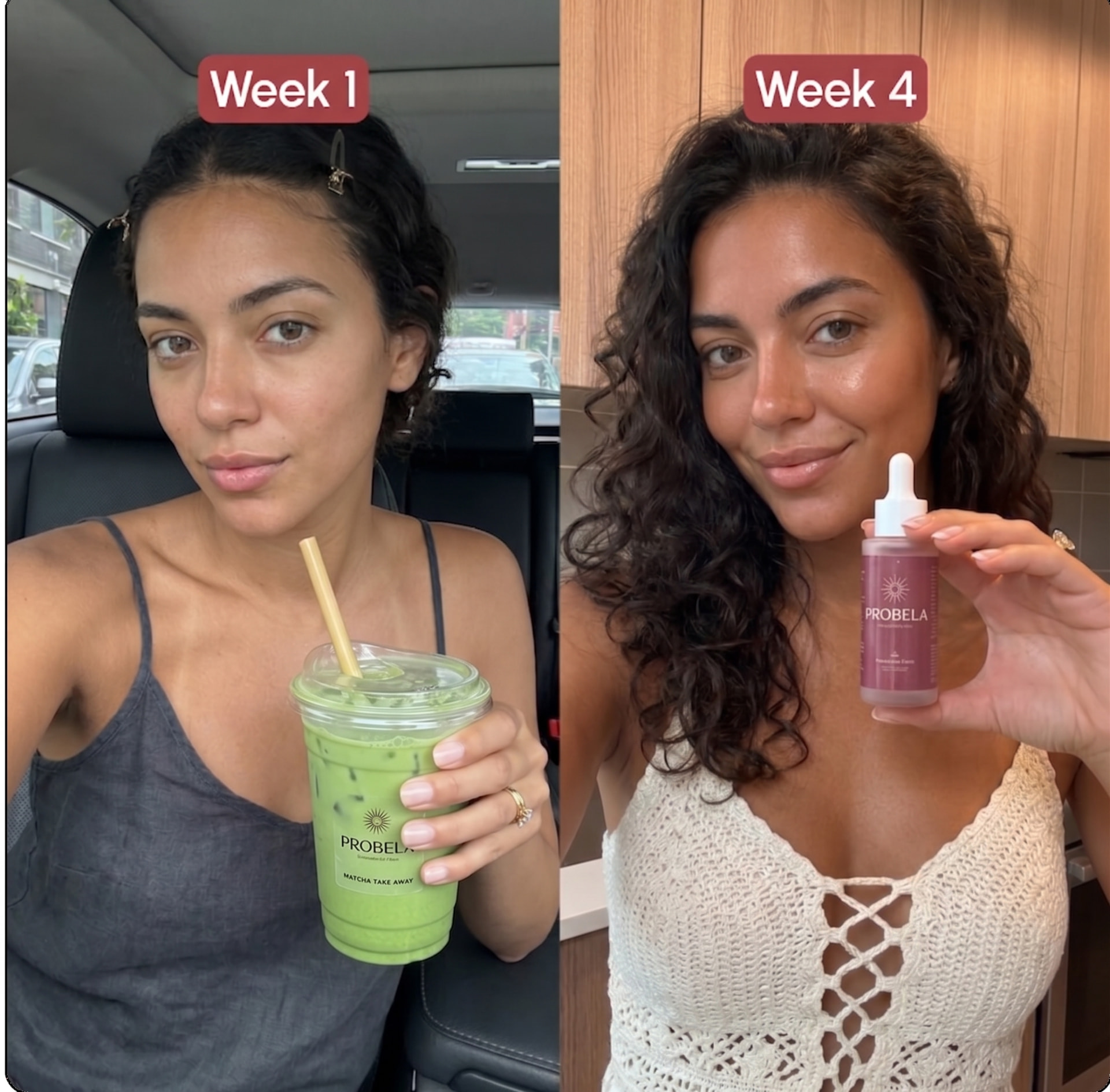 Semana 1 vs semana 4 de Camila R. com PROBELA Glow Drops