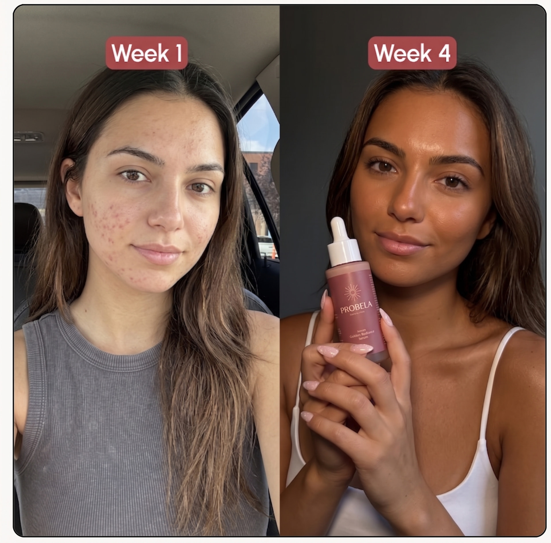Semana 1 vs semana 4 de Lucy S. com PROBELA Glow Drops